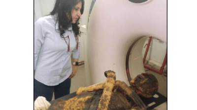 ملك مصر القديمة قتل بضربة على الرأس