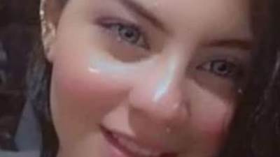 اول صور لضحية العنف الاسري اسراء بعد القيام بالجراحة لها فالمستشفي 