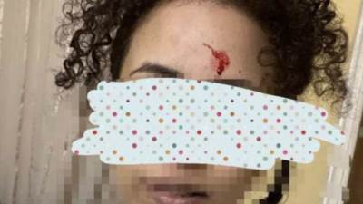 أسرة «فتاة المرج» يتركون المنزل بعد سحلهم وخطيبها: هربنا من الجيران