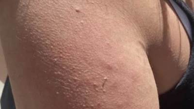 الاعتداء على فتاة الثالثة عشر عامًا في وضح النهار والتهمة الجري في رمضان. 