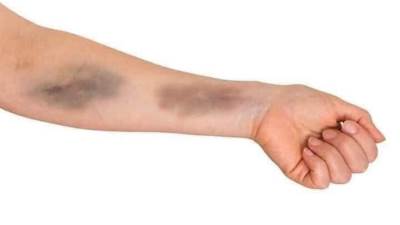 مشاجرة بالاسلحة البيضاء بين طالبتين بمدرسة السيدة رقية الثانوية التجارية بالمعادي