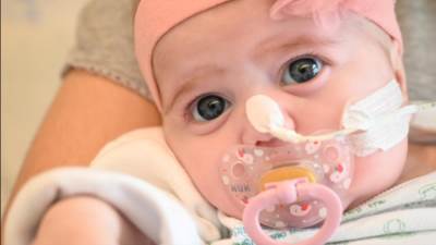 نجاح أول عملية فى العالم لزراعة قلب لطفلة إسبانية عمرها شهرين.. صور