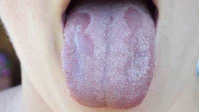 فطر أبيض يزيح الأسود ويهدد بكارثة أخطر