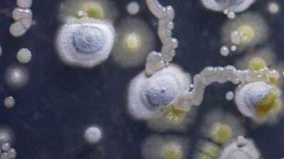 بعد انتشار الفطر الابيض والاسود الفطر الاصفر الاشد خطورة ينتشر تعرف علي الاعراض