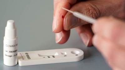 "العليا للفيروسات": الفطر الأسود غير معد وغير منتشر بمصر والوضع الوبائى مستقر