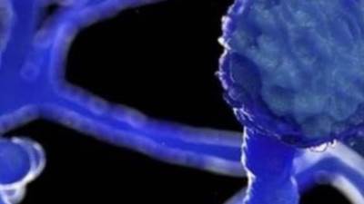 مركز السيطرة علي الامراض في امريكا تصنف سلاله دلتا من كورونا بانها مثيرة للقلق