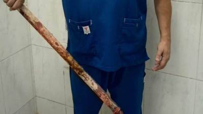 استخراج ماسورة مياه طولها متر من صدر شاب...تعرف على التفاصيل 