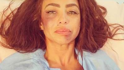 الفنانة دوللي شاهين تتعرض للاعتداء من قبل اشخاص مجهولين