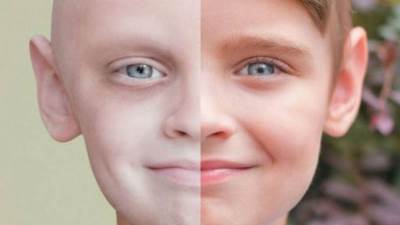 «الصحة» تحذر: 3 أنواع من السرطانات تصيب الأطفال.. وطريقة واحدة للوقاية