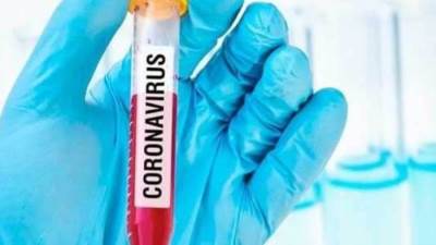 أماكن عمل اختبارات الكوفيد اللازمة لسفر المواطنين القادمين من أوكرانيا