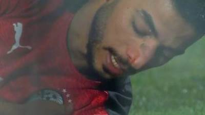 «محمد عبدالمنعم» يخضع لاختبار طبي لتحديد موعد عودته للمشاركة في التدريبات