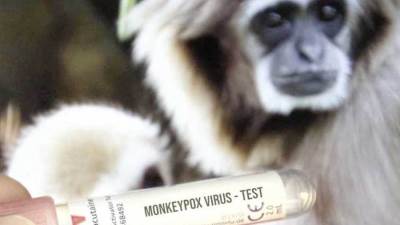 الصحة العالمية: اللقاحات المستخدمه لمرض جدري القرود فعالة بنسبة 80٪