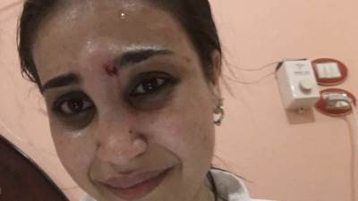 القصة كاملة.. لفتاة تستغيث من أهلها بالنجدة و والدها يكشف السبب