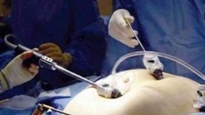 جراحة إنقاص الوزن تسبب مرض عصبي.. تقاصيل