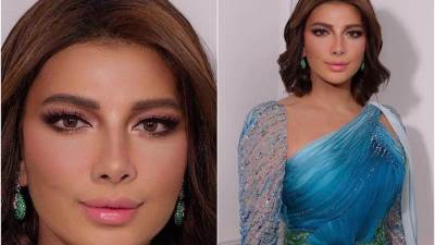 أصالة ليست الأولى التي خضعت لعمليات تجميل.. نجمات أثرن الجدل بتغيير ملامحهن