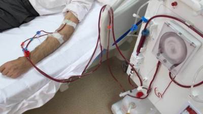 زيادة سعر جلسة الغسيل الكلوي من 325 إلى 500 جنيه للجلسة الواحدة.. ( قرار رسمي)