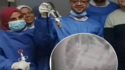 سجين يبتلع "موبايل" حاول تهريبه بسجن شبين الكوم