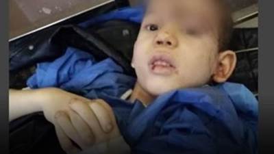 إصابة 3 أطفال هاجمتهم كلاب شرسة بجروح خطرة في حلوان