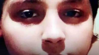 بسبب جرعة بنج زائدة.. وفاة طفل أثناء عملية جراحية في طنطا 