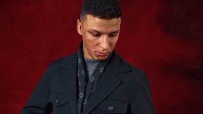 لأول مرة.. عارض أزياء من أحد مصابي الحروق في مصر والشرق الأوسط