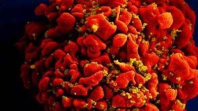 الصحة: 4 طرق للوقاية من الإصابة بفيروس الإيدز