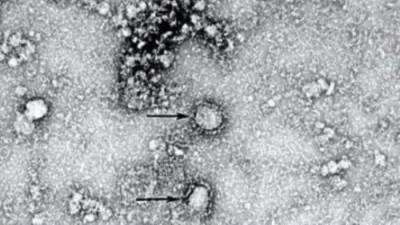 الهند تسجل أعلى زيادة يومية لإصابات فيروس كورونا منذ 236 يوما