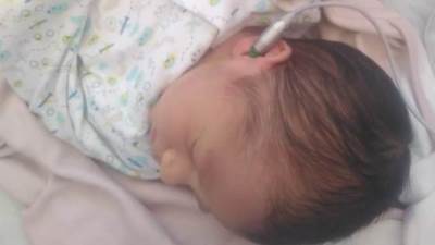 الصحة: فحص 4 ملايين و997 الف طفل للكشف المبكر وعلاج ضعف وفقدان السمع