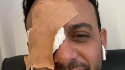 خالد سرحان يعلق على تسببه في إصابه مصطفي قمر بالخطأ في أولاد حريم كريم 