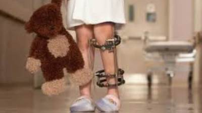 الصحة تؤكد خلو مصر من مرض شلل الأطفال