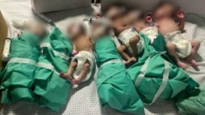 CNN: أطباء مستشفى الشفاء يضعون الأطفال المبتسرين فى ورق "فويل"