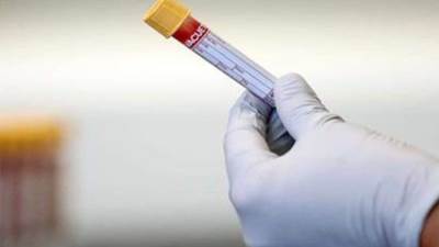 دراسة : فحص الدم قادر على اكتشاف سرطانات البنكرياس بدقة تصل إلى 97%