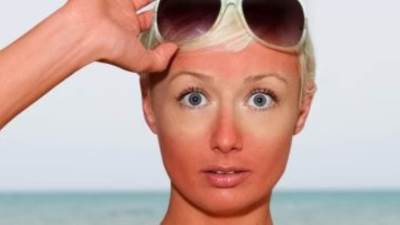 التسمم الشمسى حالة تنتج من شدة حروق الشمس.. الأعراض وطرق الوقاية