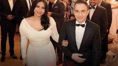 جرح قطعي في الرأس وكدمات.. حسام حبيب يتعدى على شيرين عبد الوهاب بزجاجة