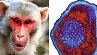 وزارة الصحة تعلن تحديث الدليل الإرشادى لتشخيص وعلاج جدرى القرود