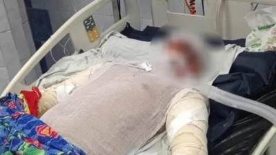 وفاة بطل حريق شبرا الخيمة متأثرا بإصاباته بحروق فى جميع أنحاء جسده