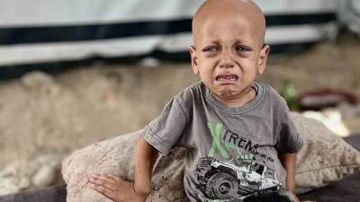 وفاة الطفل الفلسطيني صاحب عبارة "أنا جعان".. مأساة ترصدها الصور